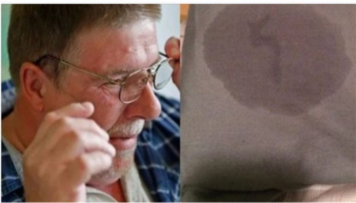 Ada cairan bening yang keluar dari telinga Mark.