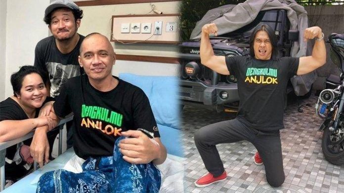 Kabar Duka, Agung Hercules Meninggal Dunia Karena Kanker Otak.