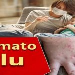 Mengenal Flu Tomat, Gejala Serta Cara Pencegahannya.
