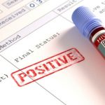 Ada 5.000 Lebih Kasus HIV-AIDS di Kota Bandung, Walkot: Jumlah Bisa Lebih Banyak dari Data