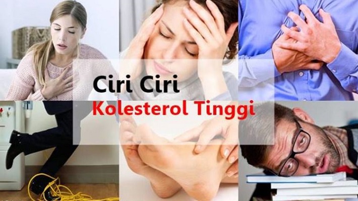 Gejala Kolesterol Tinggi
