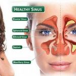 Mengenal Penyakit Sinusitis: Penyebab, Gejala serta Cara Mengobati Dengan Bahan Alami.
