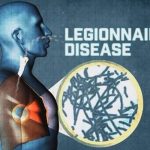 Mengenal Penyakit Legionnaire, Gejalanya Serupa Pneumonia