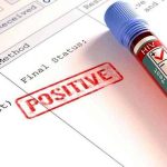 ilustrasi hasil test HIV