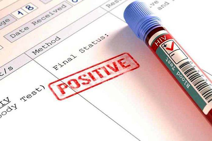 ilustrasi hasil test HIV