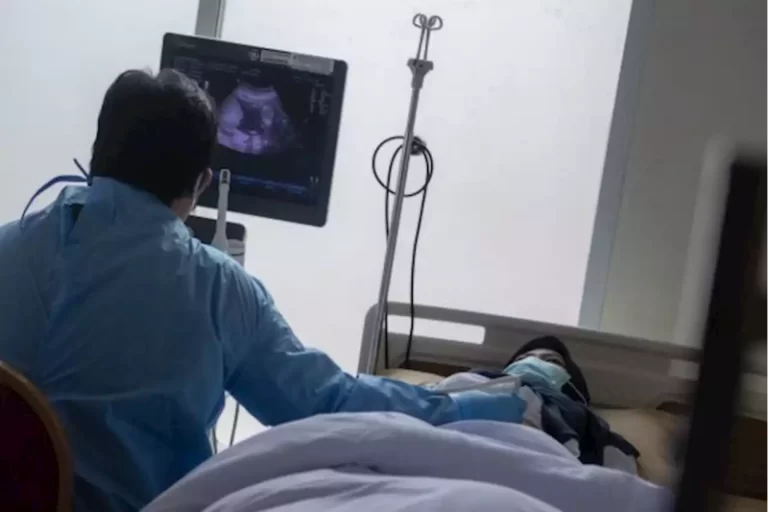 Kemenkes akan Penuhi Kebutuhan USG di Semua Puskesmas