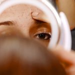 ilustrasi wajah bruntusan