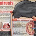 Mengenal Penyakit Leptospirosis, Gejala serta Pengobatannya.