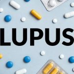 Mengenal Penyakit Lupus: Gejala, Penyebab serta Pengobatannya