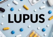 Mengenal Penyakit Lupus