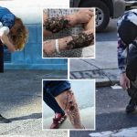 Mengenal Xylazine Atau Tranq, Narkoba Zombie yang Bikin Penggunanya Bak Mayat Hidup