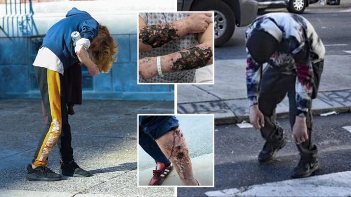 Mengenal Xylazine Atau Tranq