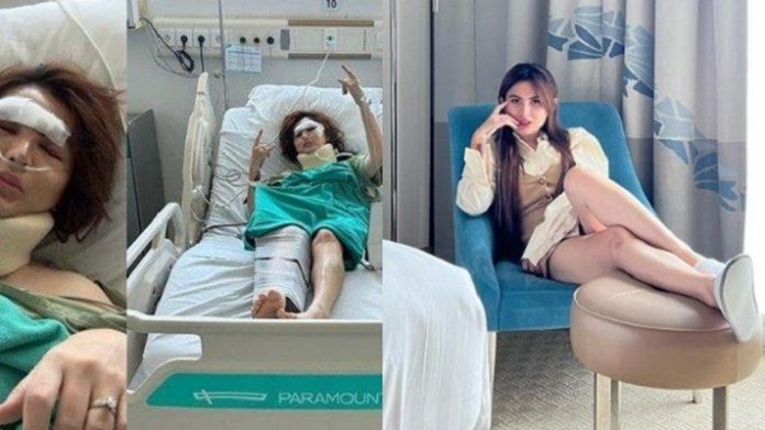 Selebgram Angela Lee Kecelakaan Mobil di Tol