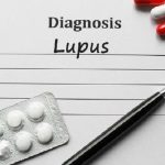 Mengenal Penyakit Lupus: Gejala, Penyebab serta Pengobatannya.