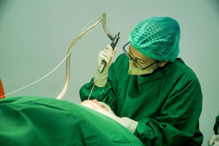 Fat Graft Banyak Diminati,  NMW Aesthetic Clinic & Plastic Surgery Kini hadir di Surabaya