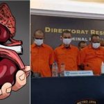 Sindikat Perdagangan Ginjal di Kamboja Ungkap Pasien Jual Ginjal Faktor Ekonomi.