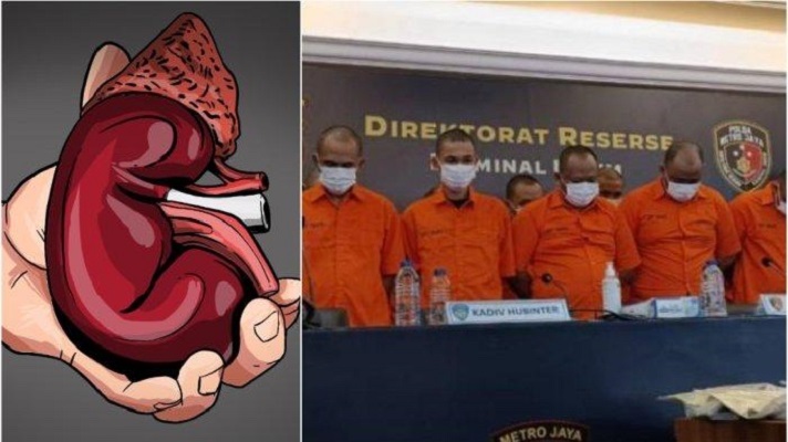 Sindikat Perdagangan Ginjal di Kamboja