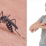 Tips Hilangkan Bekas Gigitan Nyamuk, Anti Ribet dan Mudah Dilakukan