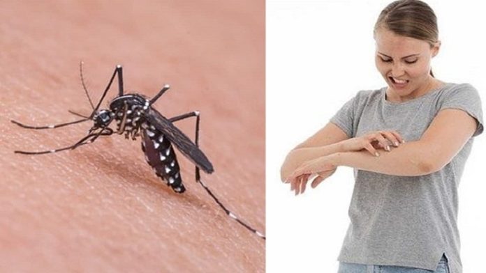 Tips Hilangkan Bekas Gigitan Nyamuk