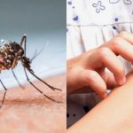 Tips Hilangkan Bekas Gigitan Nyamuk, Anti Ribet dan Mudah Dilakukan.