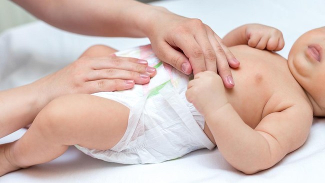 Mencegah Ruam Popok