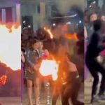 Jenggot Limbad Terbakar Saat Lakukan Atraksi, Alami Luka Bakar Hingga Harus Operasi.