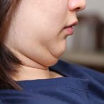 Hilangkan Double Chin