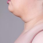 Hilangkan Double Chin