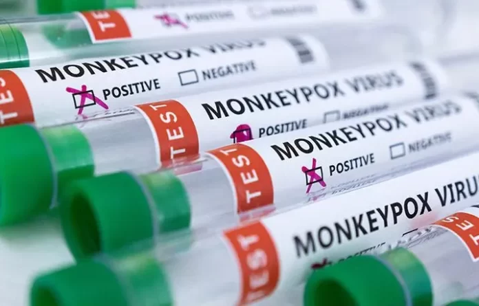 Cacar Monyet di Jakarta