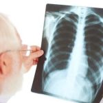 ilustrasi-skrining-tbc-dengan-rontgen-dada-freepik