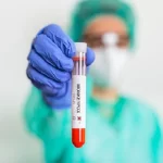 Dinkes DKI Cacar Monyet