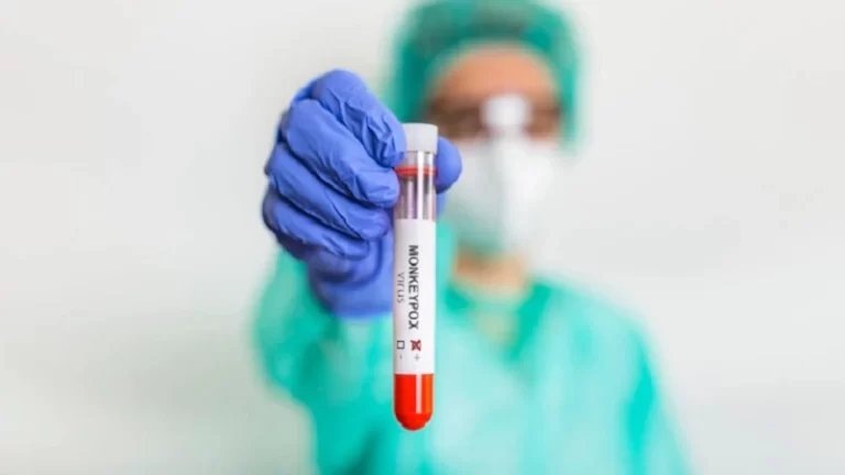 Dinkes DKI Cacar Monyet