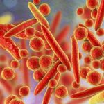 bakteri-mycoplasma-penyebab-pneumonia-infeksi-pada-alat-kelamin-_180118102550-291