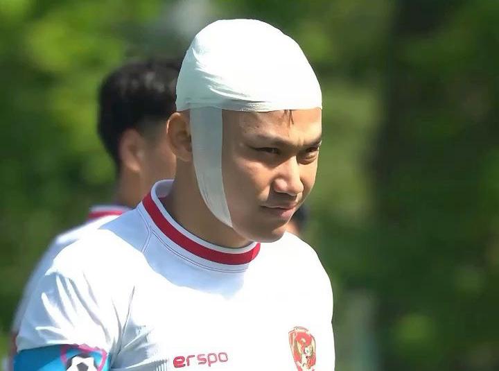 Pecinya Witan Curi Perhatian! Tapi Semangatnya Tak Terkalahkan!