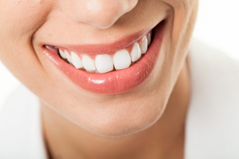 Memutihkan Gigi dengan Bahan Alami: Benarkah Efektif dan Aman untuk Gigi Anda?