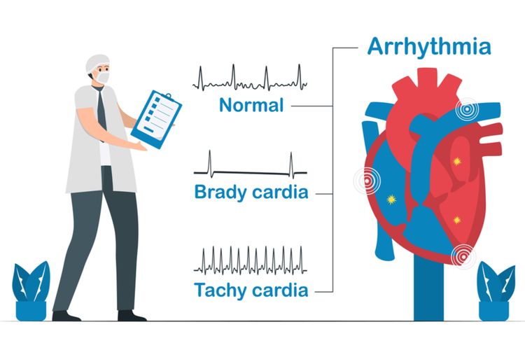 Kenali Aritmia Jantung: Gejala, Penyebab, dan Pencegahannya