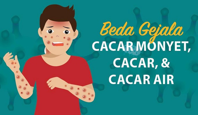 Waspada Cacar Air