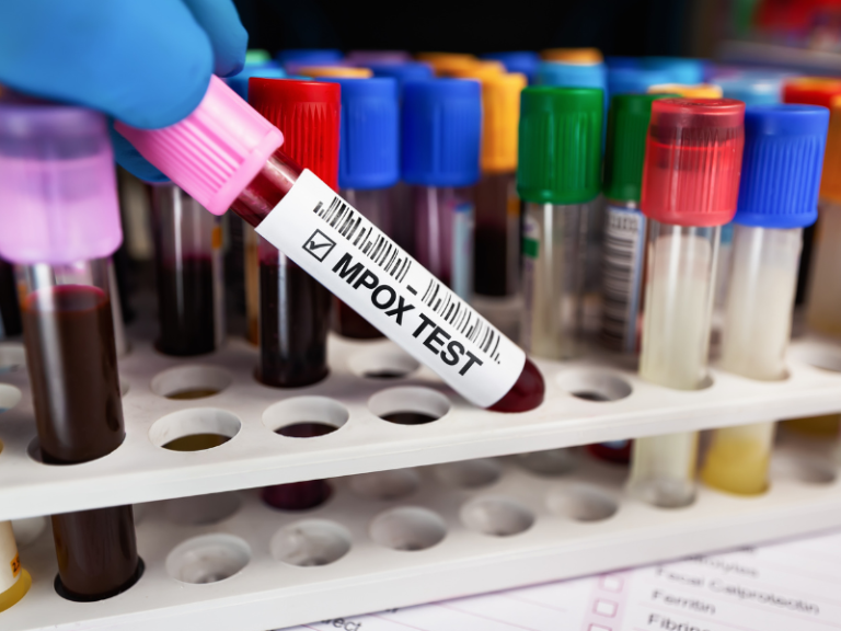 WHO Beri Lampu Hijau: Tes PCR Real Time Kini Dapat Deteksi Mpox