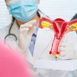 jangan-takut-dengan-kista-ovarium