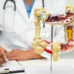 vecteezy_intestine-appendix-and-digestive-system-doctor-holding_51019075-1-1701155399