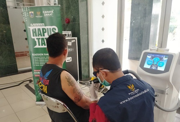 Baznas Gelar Layanan Hapus Tato Gratis