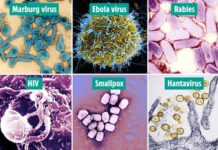 Daftar Virus Paling Mematikan di Dunia Berdasarkan Tingkat Fatalitas, Covid Ada? Daftar Virus Paling Mematikan